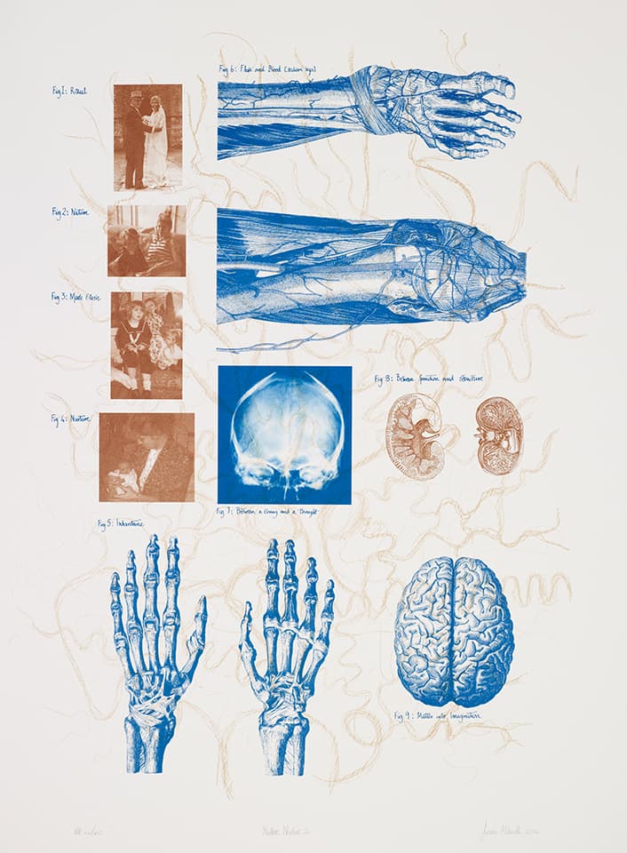 <strong>Nature Nurture 2</strong>, Susan Aldworth, lithograph, 77 x 60 cms, 2012. Photograph by Anna Arca.